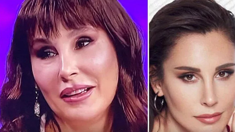 Son hali çok konuşulmuştu... Bengüden açıklama geldi