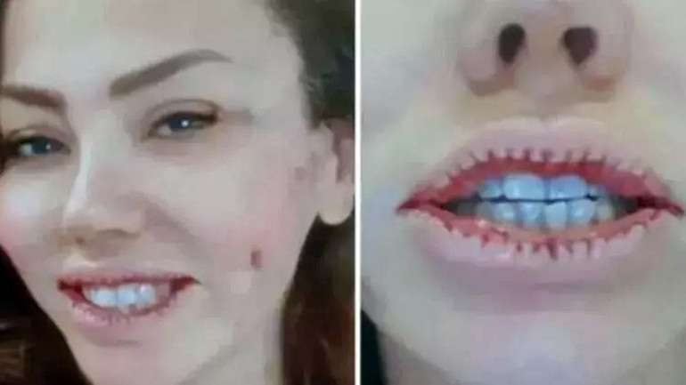 Son hali çok konuşulmuştu... Bengüden açıklama geldi