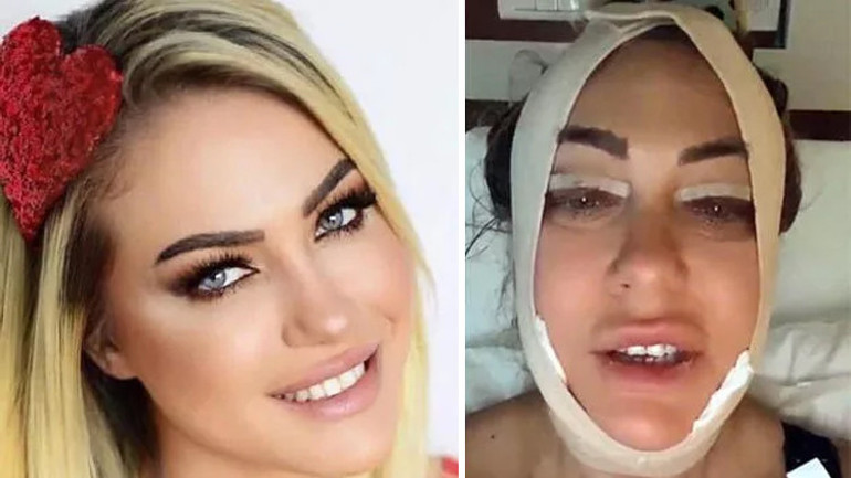 Son hali çok konuşulmuştu... Bengüden açıklama geldi