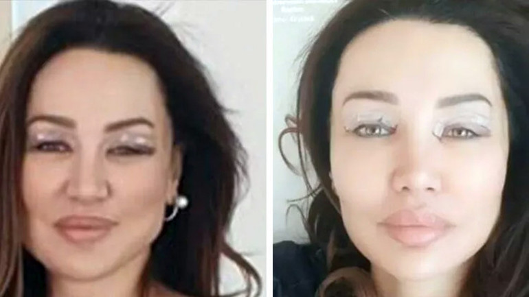 Son hali çok konuşulmuştu... Bengüden açıklama geldi