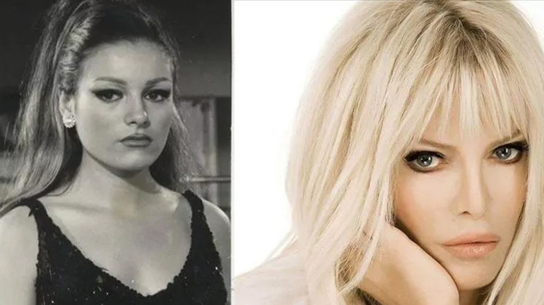 Son hali çok konuşulmuştu... Bengüden açıklama geldi