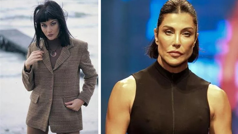 Son hali çok konuşulmuştu... Bengüden açıklama geldi