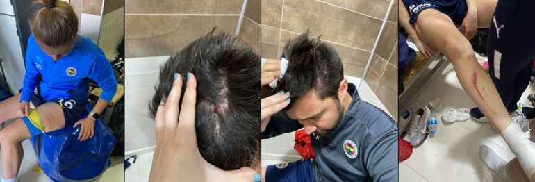Amed Sportif Faaliyetler-Fenerbahçe kadın futbol maçında ortalık karıştı Tekme ve yumruklar...