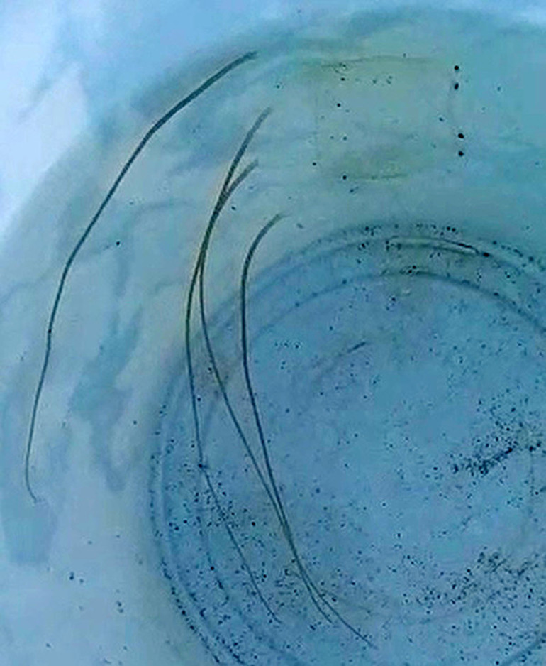 TÜDAV uyardı, işte tehlikeli denizanası türleri