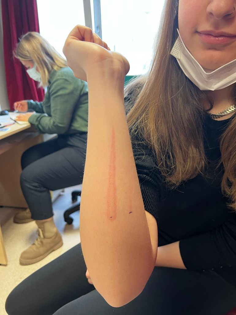 15 dakikadan fazla dışarıda duramıyor… ‘Okula yürüyerek gitmek onu öldürebilir