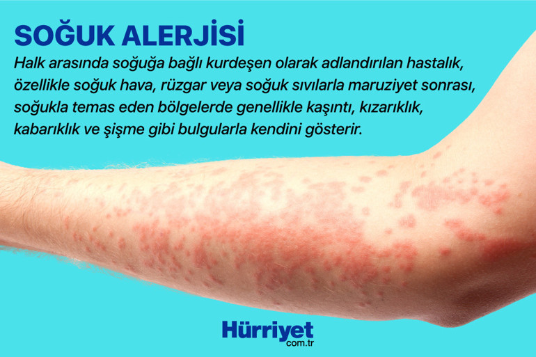 15 dakikadan fazla dışarıda duramıyor… ‘Okula yürüyerek gitmek onu öldürebilir