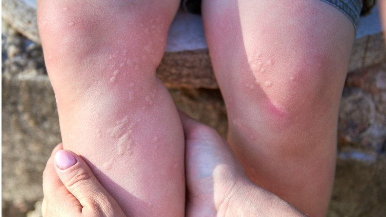 15 dakikadan fazla dışarıda duramıyor… ‘Okula yürüyerek gitmek onu öldürebilir