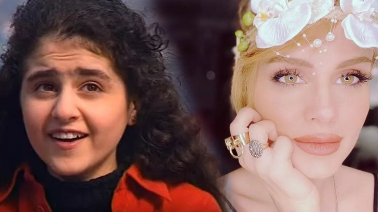 Bir dönem podyumda fırtına gibi esmişti... Estetik iddialarına çocukluk fotoğrafı ile yanıt verdi