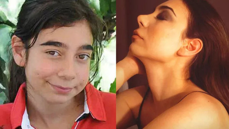 Bir dönem podyumda fırtına gibi esmişti... Estetik iddialarına çocukluk fotoğrafı ile yanıt verdi