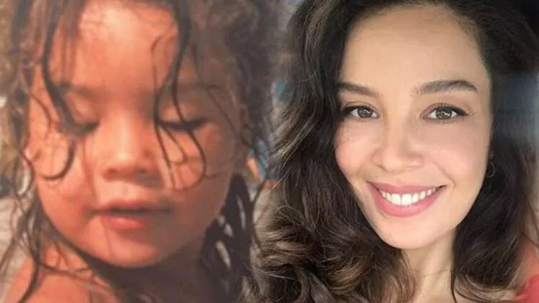 Bir dönem podyumda fırtına gibi esmişti... Estetik iddialarına çocukluk fotoğrafı ile yanıt verdi