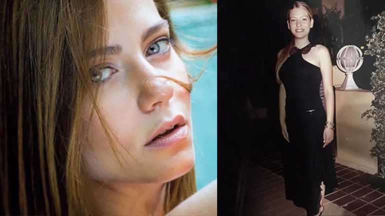 Bir dönem podyumda fırtına gibi esmişti... Estetik iddialarına çocukluk fotoğrafı ile yanıt verdi