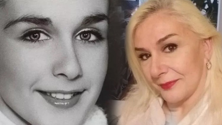 Bir dönem podyumda fırtına gibi esmişti... Estetik iddialarına çocukluk fotoğrafı ile yanıt verdi