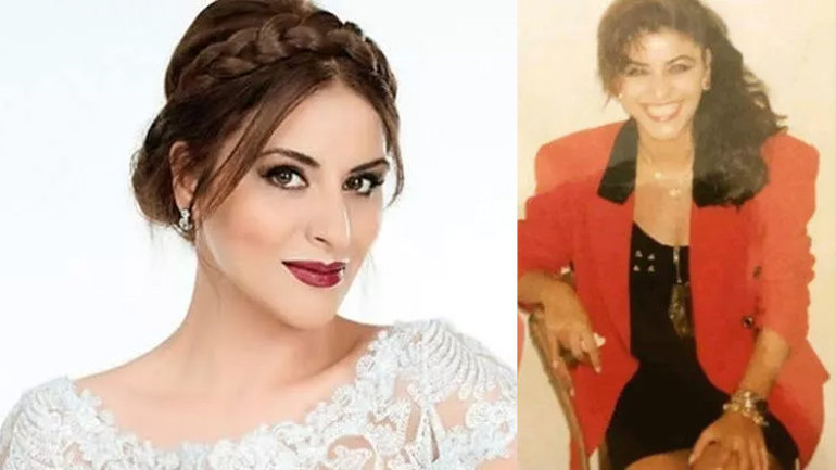 Bir dönem podyumda fırtına gibi esmişti... Estetik iddialarına çocukluk fotoğrafı ile yanıt verdi
