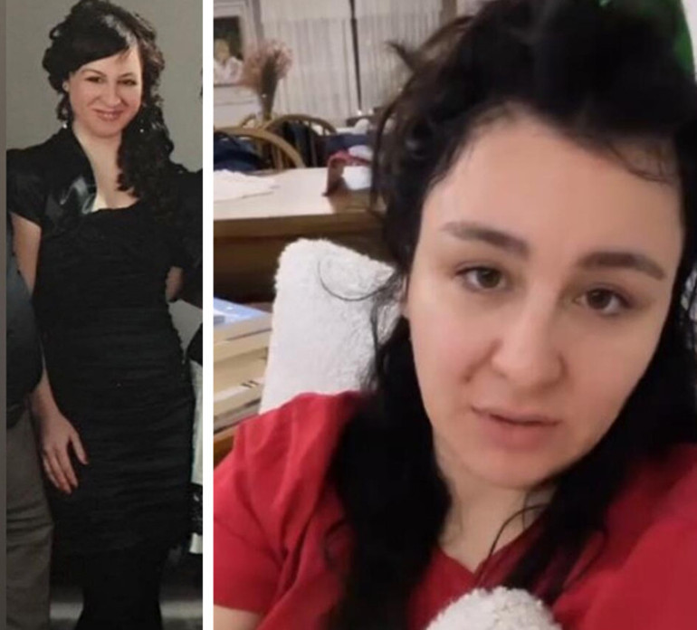 Bir dönem podyumda fırtına gibi esmişti... Estetik iddialarına çocukluk fotoğrafı ile yanıt verdi