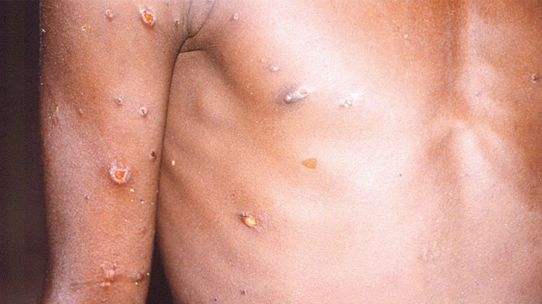 Uzmanlar da şaşkın Nereden çıktı bu maymun çiçeği