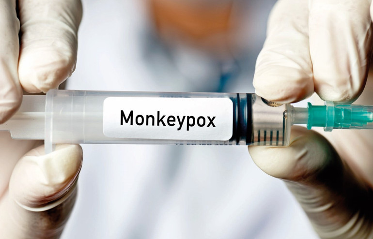 10 soruda maymun çiçeği