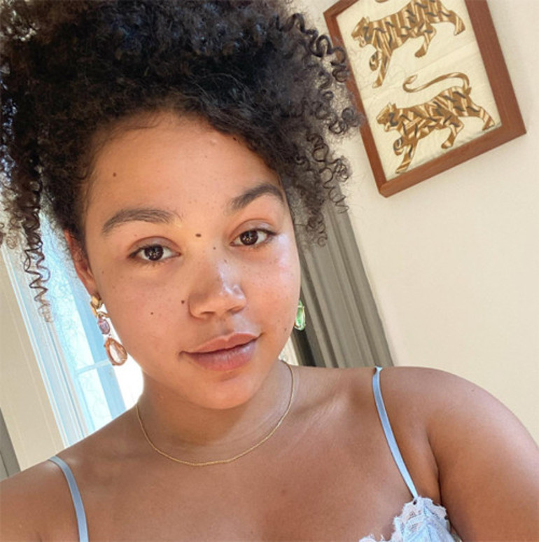 Bir diziyle ünlü olmuştu: Genç oyuncudan şoke eden paylaşım... Şu anda akıl hastanesindeyim