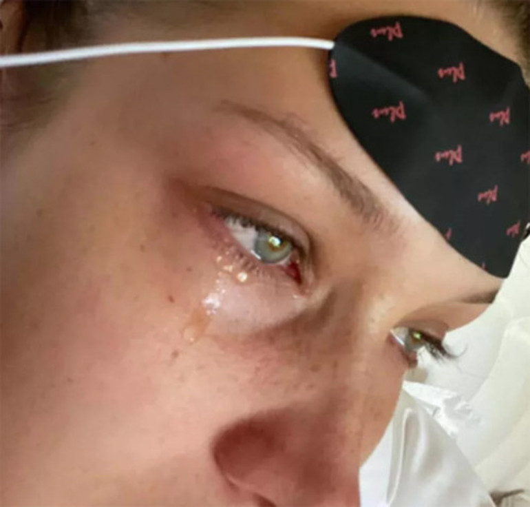 Bir diziyle ünlü olmuştu: Genç oyuncudan şoke eden paylaşım... Şu anda akıl hastanesindeyim