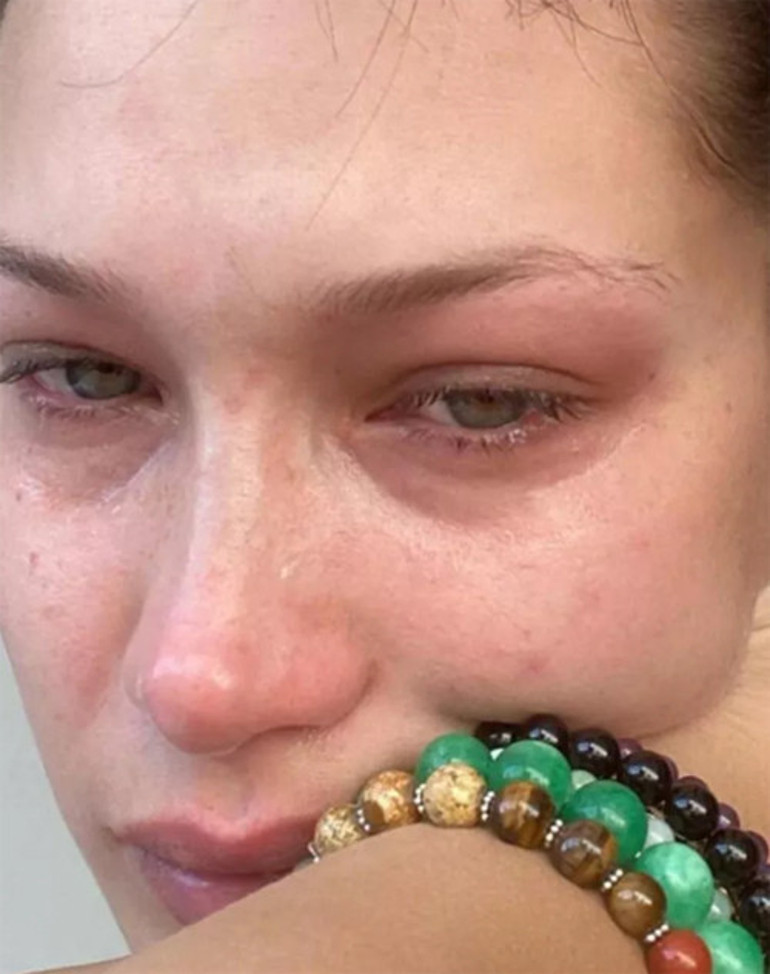 Bir diziyle ünlü olmuştu: Genç oyuncudan şoke eden paylaşım... Şu anda akıl hastanesindeyim