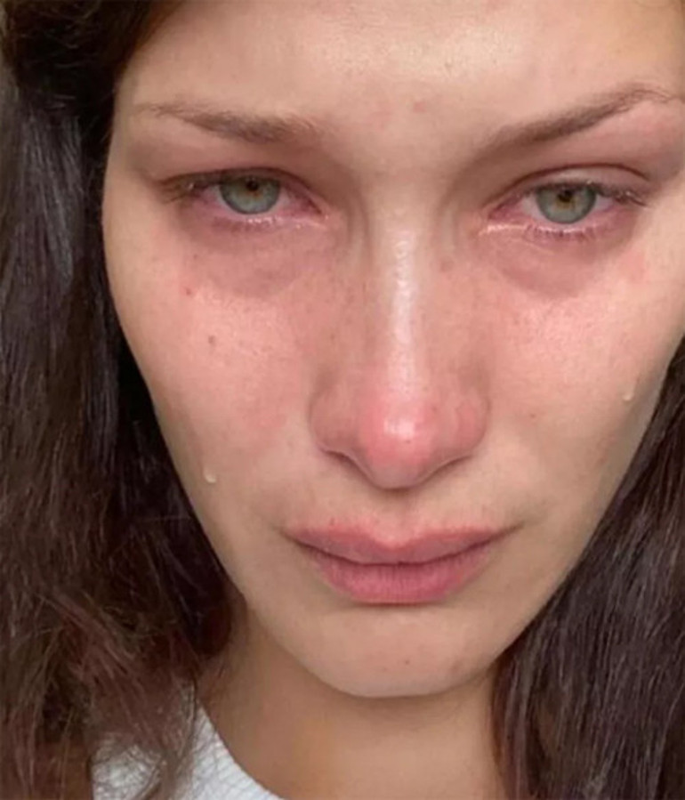 Bir diziyle ünlü olmuştu: Genç oyuncudan şoke eden paylaşım... Şu anda akıl hastanesindeyim