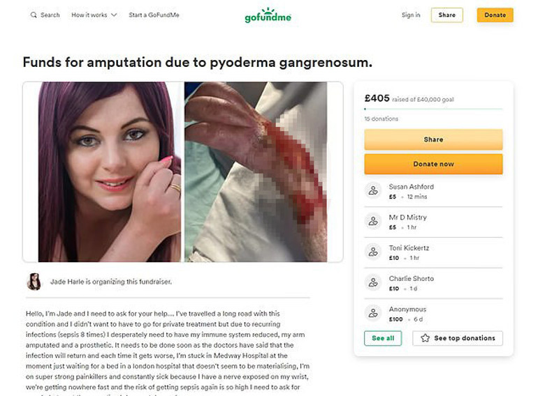 Hayat kurtarırken hayatı karardı… Doktorlara yalvarıyor: Lütfen kolumu kesin