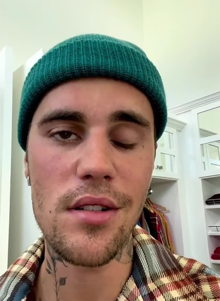 Justin Bieber, kötü haberi sosyal medyadan duyurdu: Beni dualarınızdan eksik etmeyin