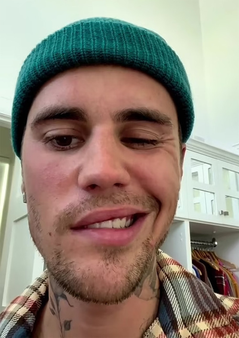Justin Bieber, kötü haberi sosyal medyadan duyurdu: Beni dualarınızdan eksik etmeyin