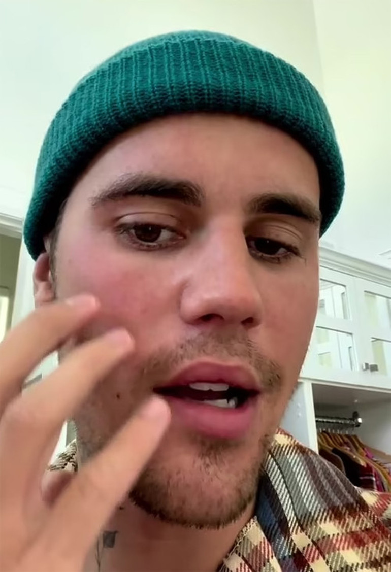 Justin Bieber, kötü haberi sosyal medyadan duyurdu: Beni dualarınızdan eksik etmeyin