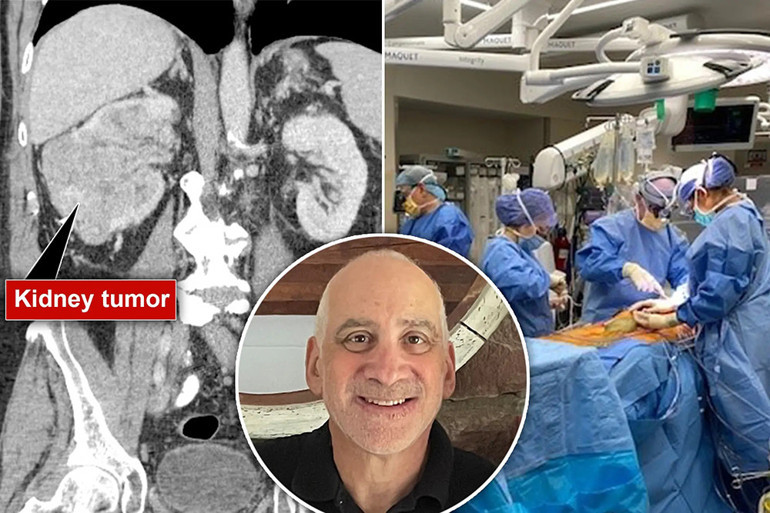 Parmağındaki ağrı bir türlü geçmedi… Doktor acı gerçeği açıkladı: Sadece 4 gün ömrün var