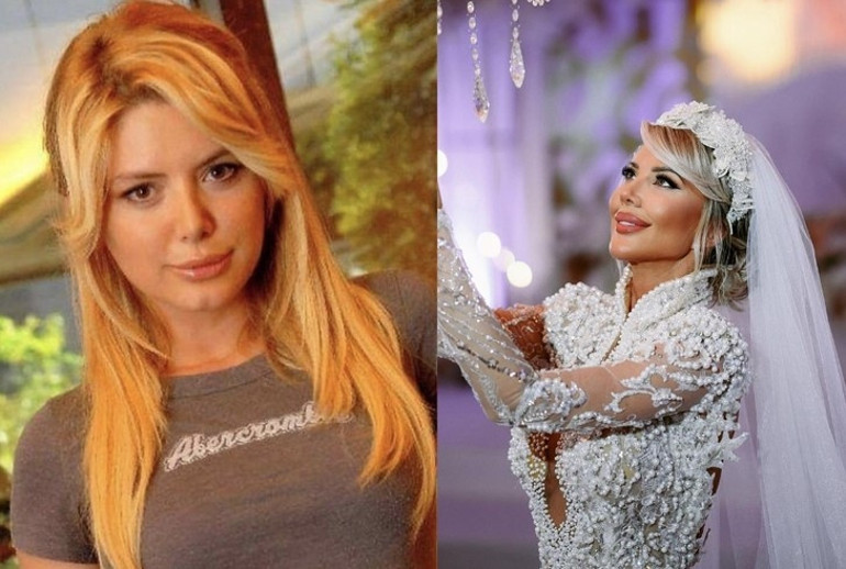 Aysun Kayacı’nın sırrı ne