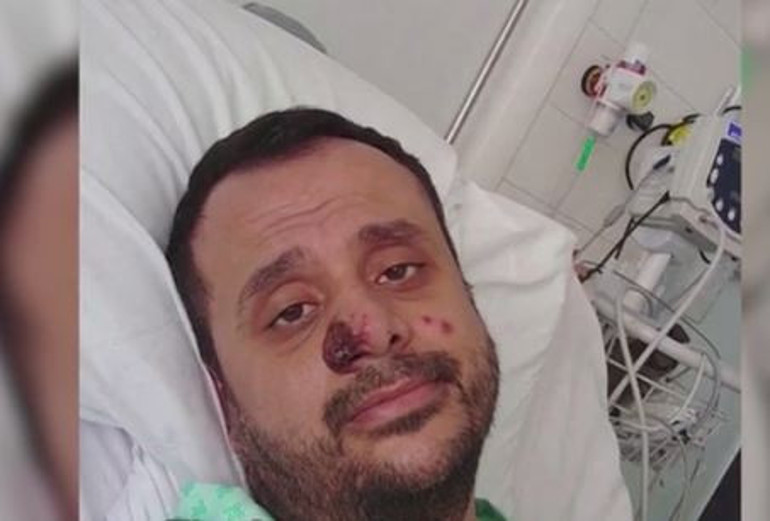 78 ülkede görüldü... Maymun Çiçeğine yakalananlar yaşadıkları kabusu anlattı...