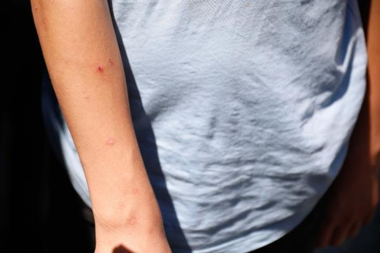 İstanbulda Aedes sivrisineği tehdidi Sayıları giderek artıyor... Uzman isimden önemli uyarı