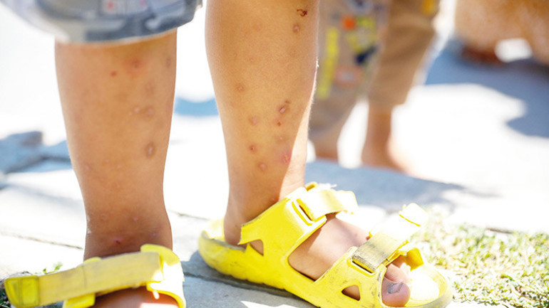 İstanbul’da Aedes paniği