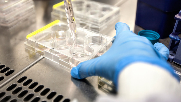 Havuzda kene yapıştı sonrasına başına gelenler hayatını alt üst etti