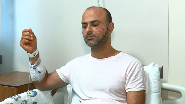 İstenmeyen tüyler için en etkili çözüm ama... Herkesin başına gelebilir