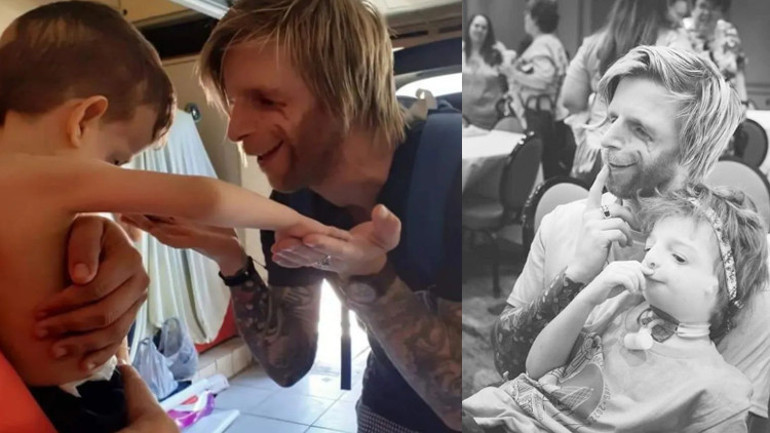 Ailesi görünüşü nedeni ile doğduktan 36 saat sonra terk etti Bir kız beni öptükten sonra hayatım değişti