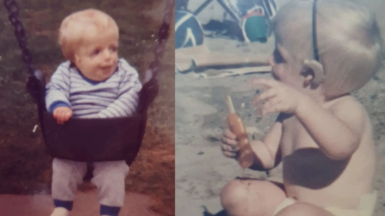 Ailesi görünüşü nedeni ile doğduktan 36 saat sonra terk etti Bir kız beni öptükten sonra hayatım değişti