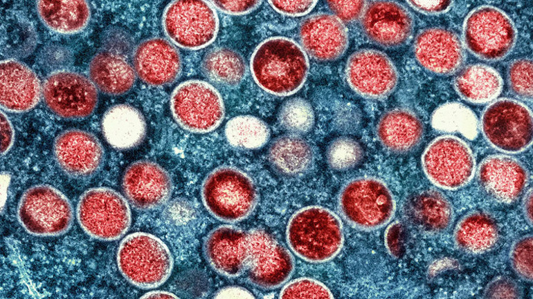 Maymun çiçeği hastalığı ilk kez bir evcil hayvana bulaştı Mutasyon endişesi...