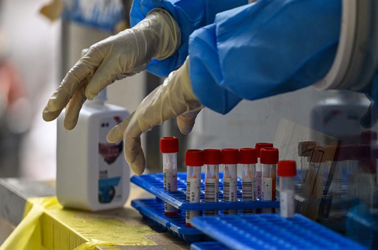 Bu haber koronavirüs geçirenleri ilgilendiriyor: Korkutan araştırma sonucu... Bu belirtiler Covidi atlattıktan 2 yıl sonra başlıyor