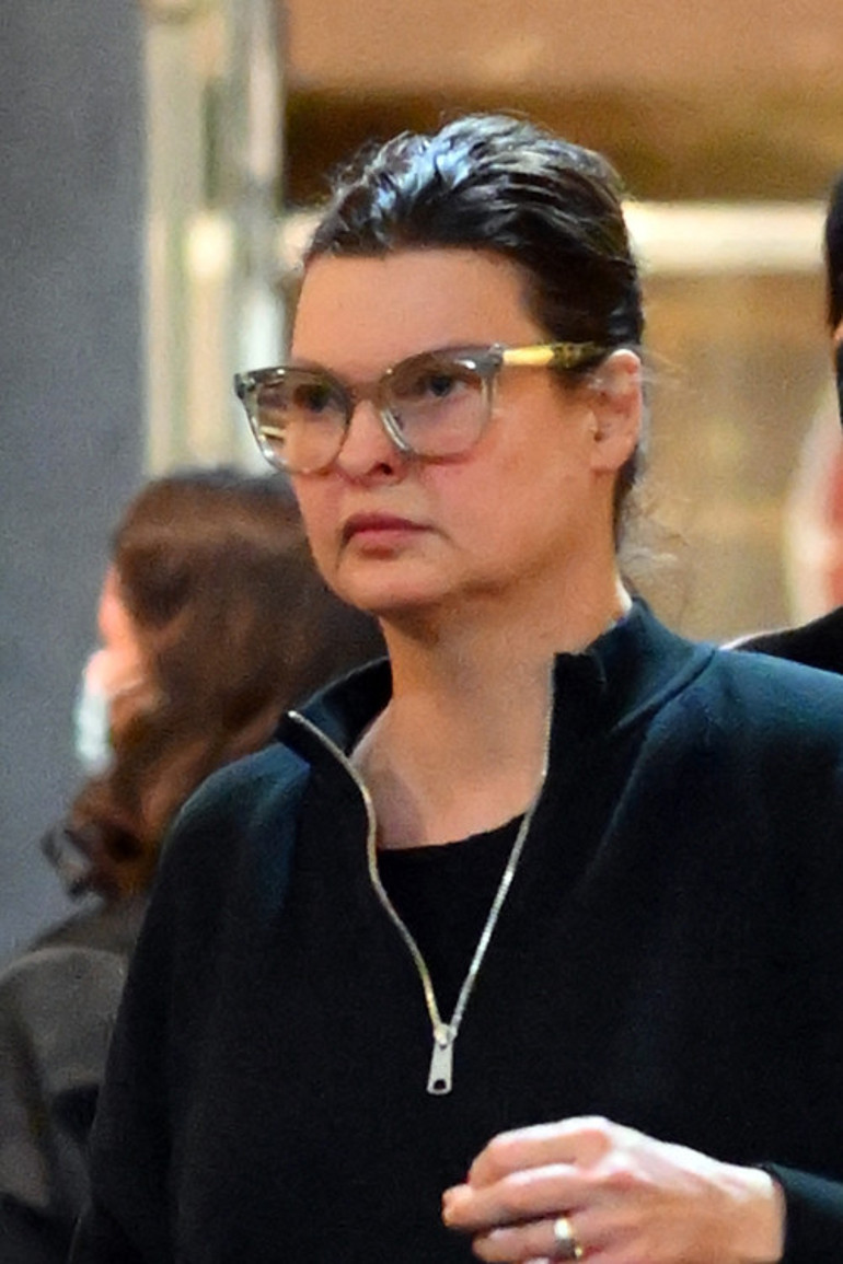 Güzellik uğruna estetik kurbanı olan top modelden acı itiraf: Reklamlara kandım, pişmanım