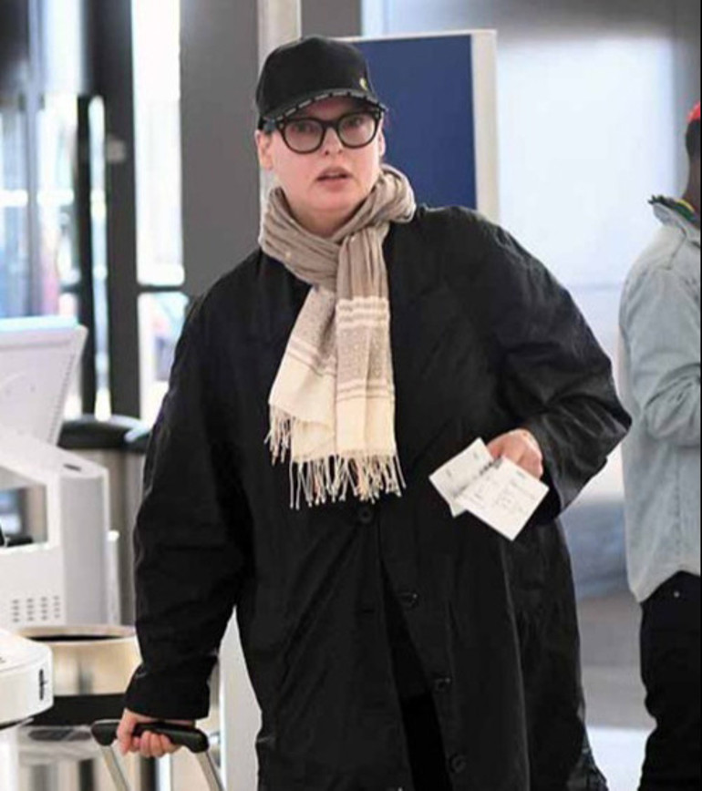 Güzellik uğruna estetik kurbanı olan top modelden acı itiraf: Reklamlara kandım, pişmanım