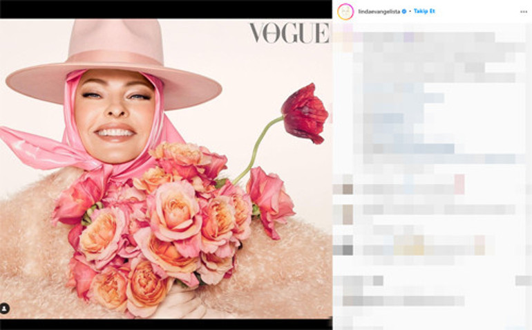 Güzellik uğruna estetik kurbanı olan top modelden acı itiraf: Reklamlara kandım, pişmanım