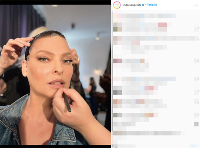 Güzellik uğruna estetik kurbanı olan top modelden acı itiraf: Reklamlara kandım, pişmanım