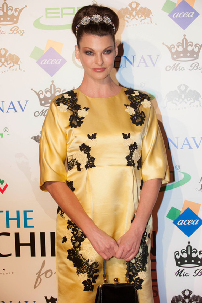 Güzellik uğruna estetik kurbanı olan top modelden acı itiraf: Reklamlara kandım, pişmanım