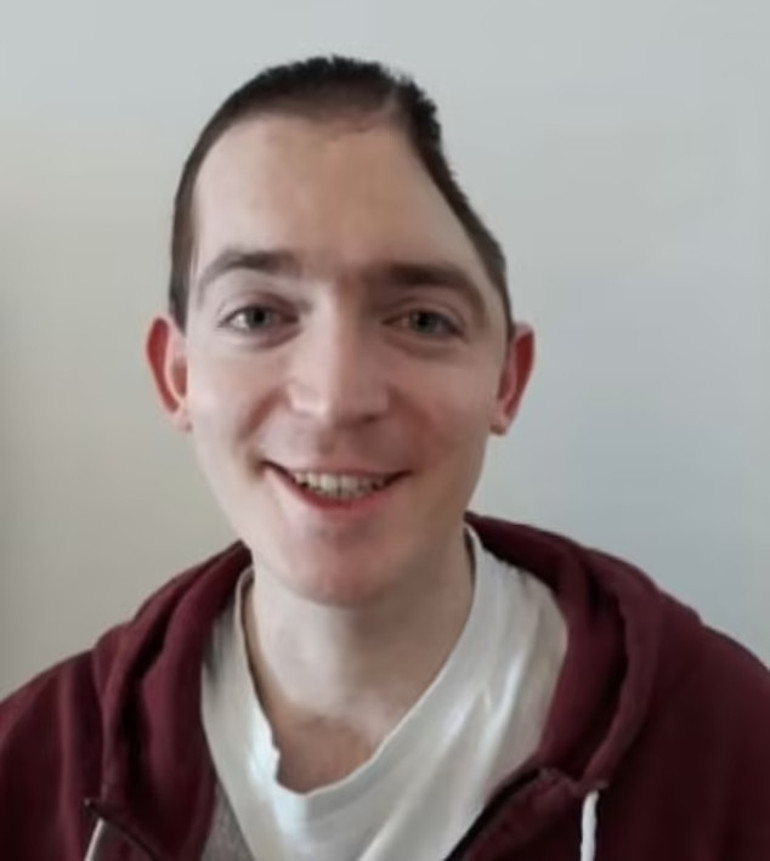 İş çıkışı gittiği eğlence yüzünden hayatı karardı… Çalıştığı firmaya 200 bin sterlinlik dava açtı