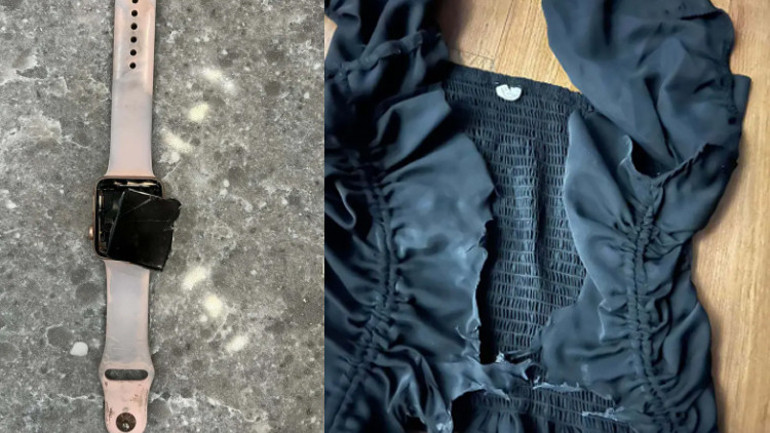 Okulun ilk gününde göğsüne yıldırım düştü Kıyafetleri erdi, saati patladı