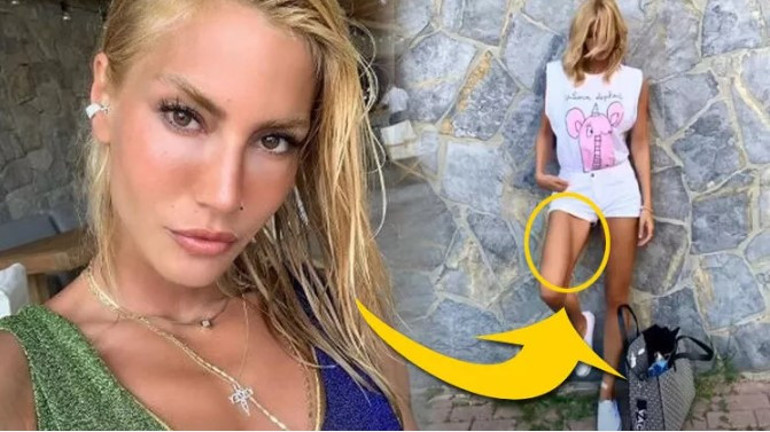 Paylaşımı takipçilerini ikiye böldü... Bu nasıl 34 beden Buse