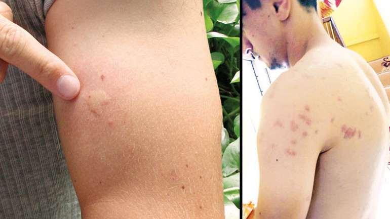 Yunanistan alarm verdi... Türkiye için sivrisinek uyarısı geldi