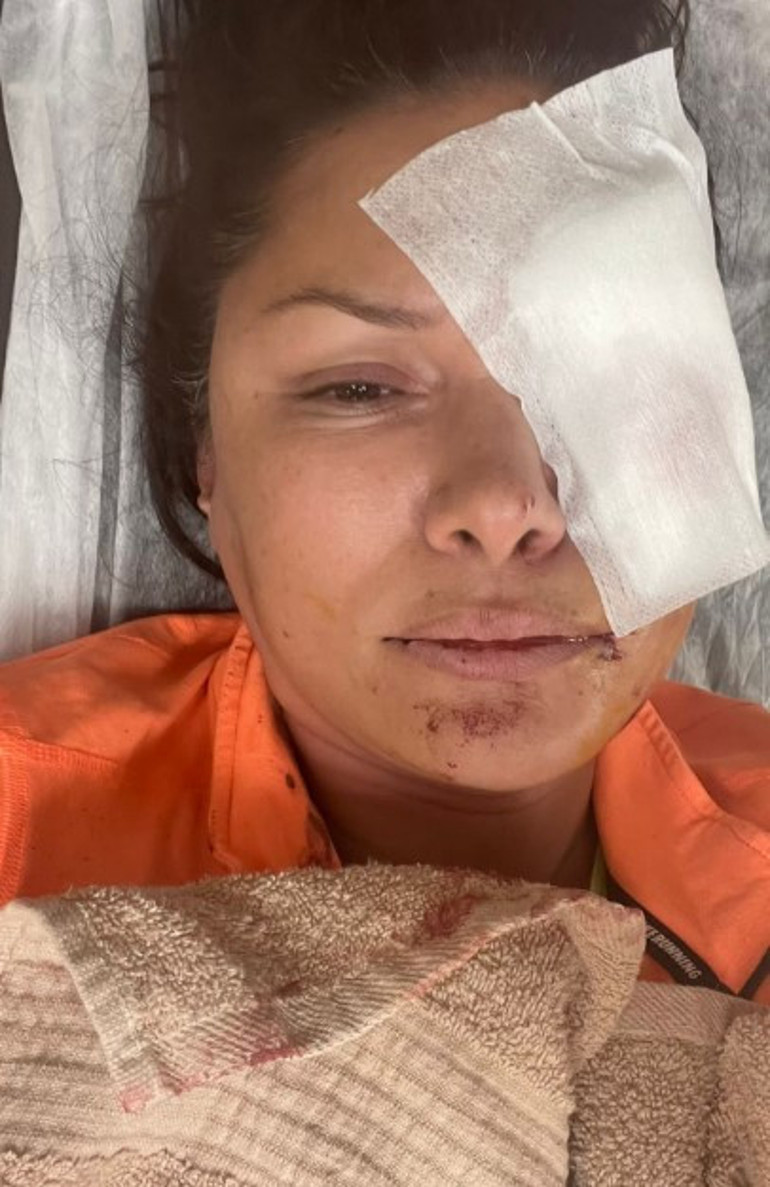 Şilede korkunç olay Ünlü mankene köpek saldırdı