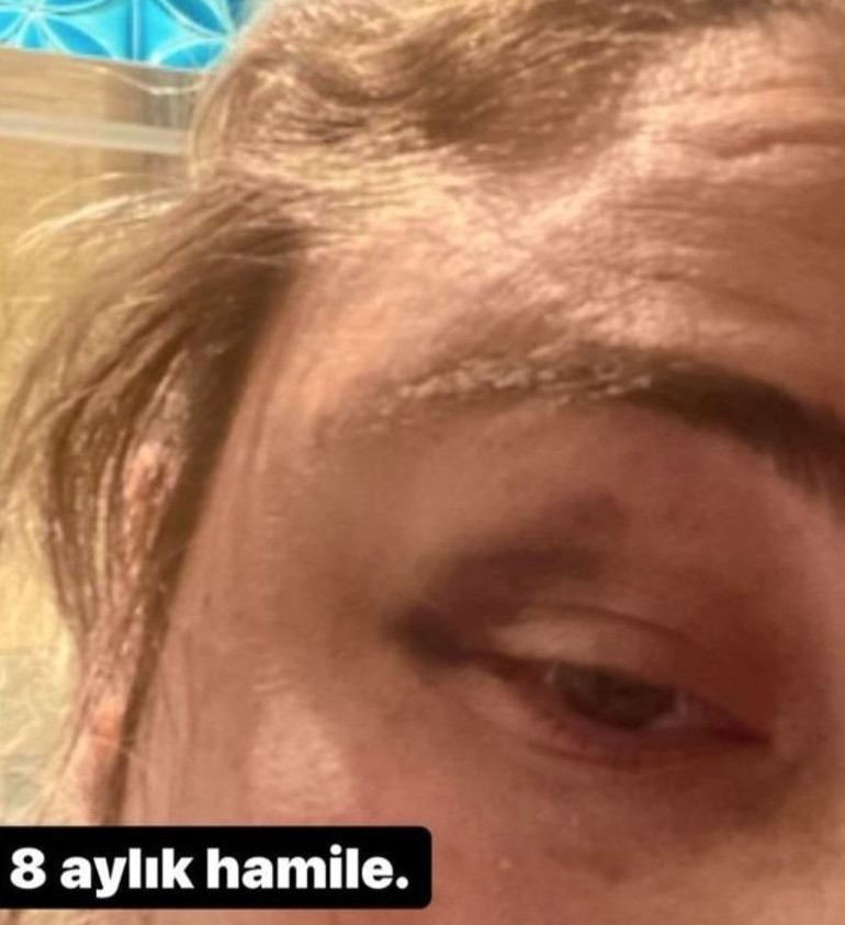 Kaan Boşnak ve eşi Başak Torun’dan karşılıklı suçlamalar